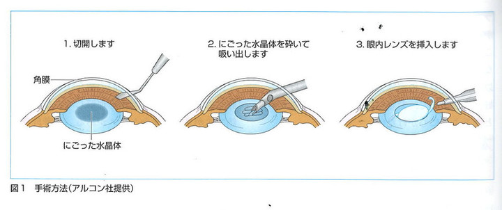 611