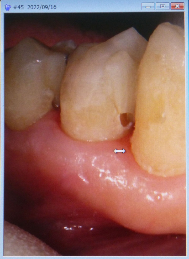 P1150492s